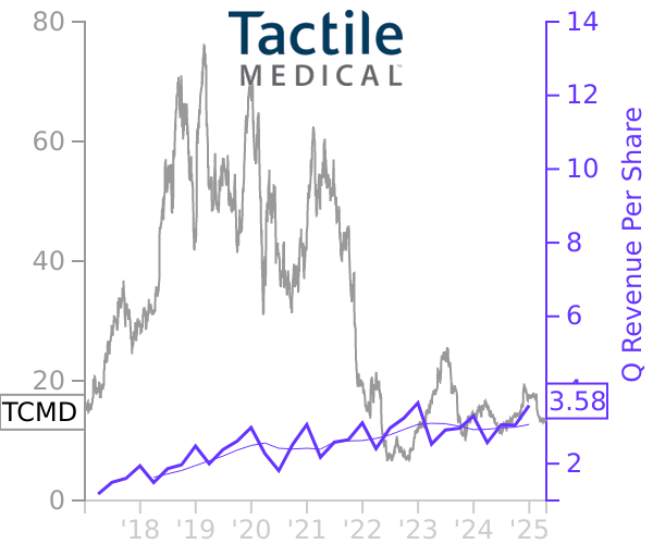 TCMD stock chart compared to revenue