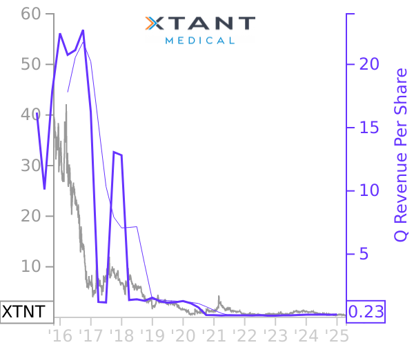 XTNT stock chart compared to revenue